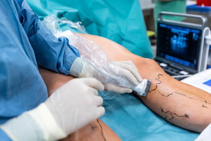 Vascular Surgery: When Should You See a Vascular Specialist?